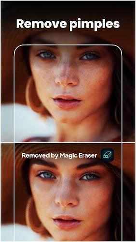 Magic Eraser - Remove Object screenshot 10