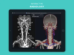 Complete Anatomy 2024 screenshot 15